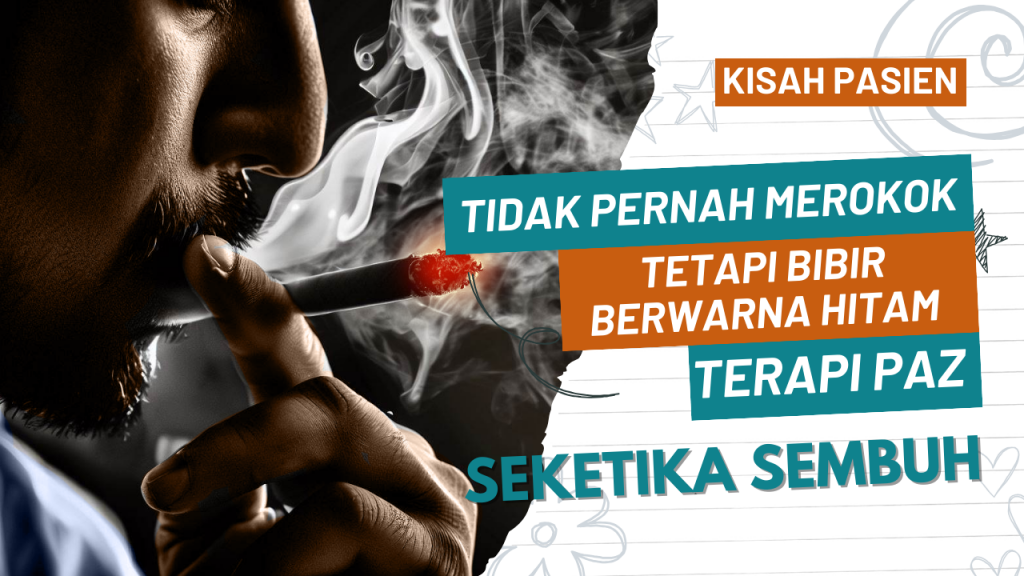 bibir hitam akibat merokok